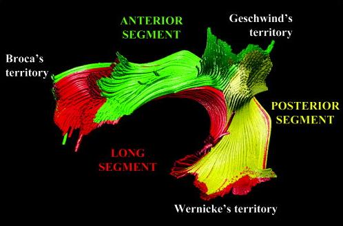 Tractography reconstruction of the arcuate fasciculus showing Broca’s and Wernicke’s areas being connected through three segments: a long, direct pathway (classical arcuate); an anterior, indirect pathway; and, a posterior, indirect pathway. Taken from Catani et al. (2004).